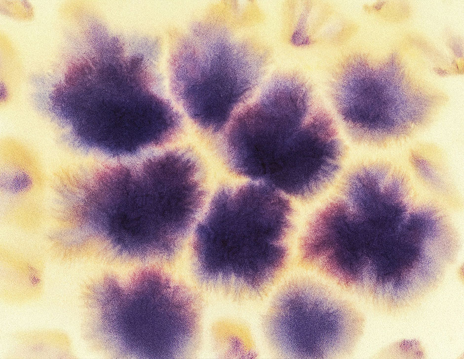 Microdosing GLP-1 and LDN: A Powerful Duo for Inflammation