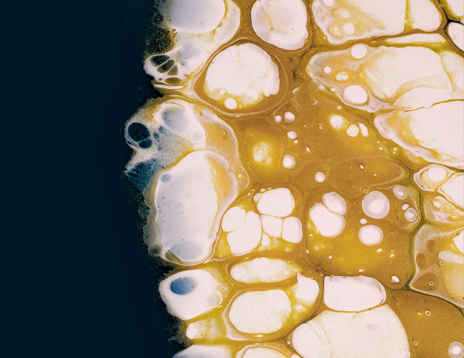 What Chronic Fatigue Teaches Us About Aging, Immunity, and Cellular Repair