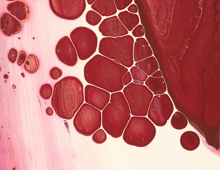 What Is Atorvastatin?