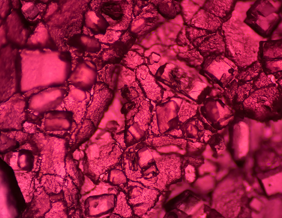 What Metformin Does: Beyond Blood Sugar Control