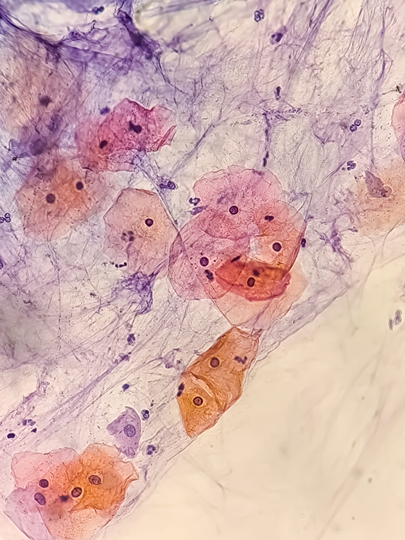 Microscope image of stained cells in pink, orange, and purple tones showing cell structures and nuclei