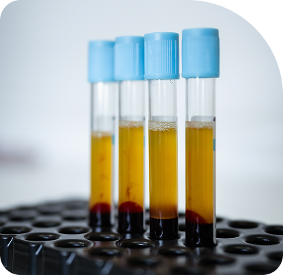 vials of blood in lab