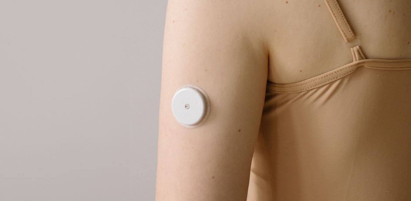 cgm-sensor on arm