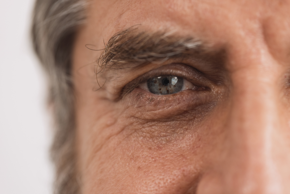 middle aged man's eye looking at camera