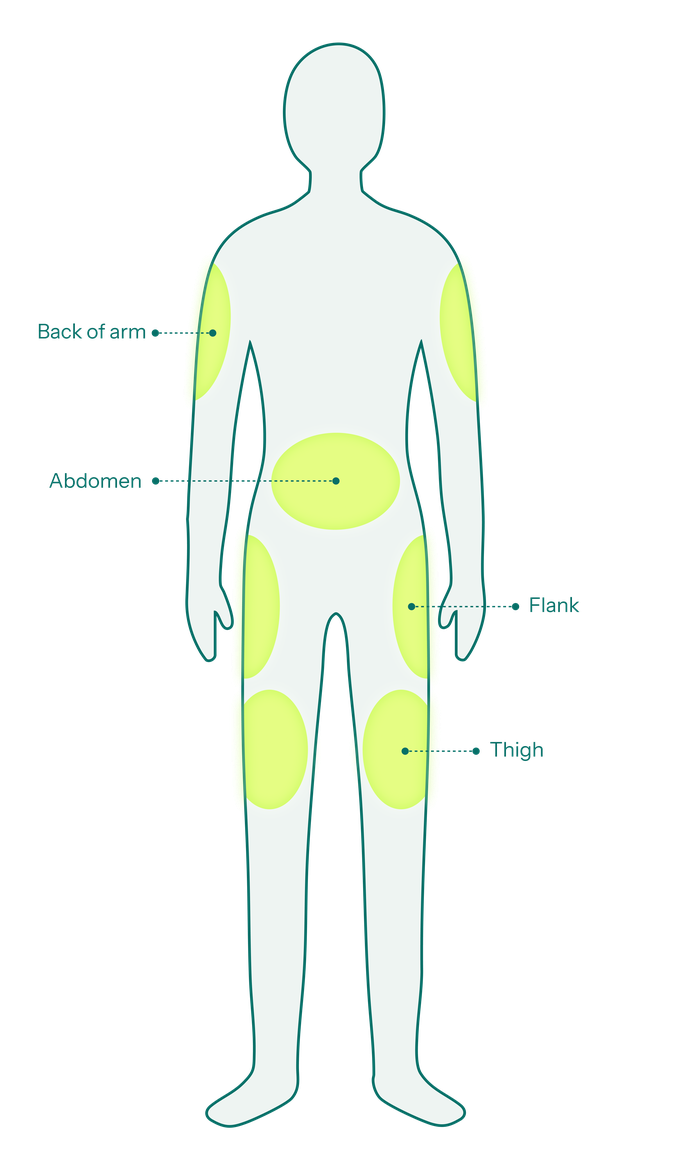 Recommended subcutaneous injection sites: back of the upper arm, abdomen, flank, and thigh
